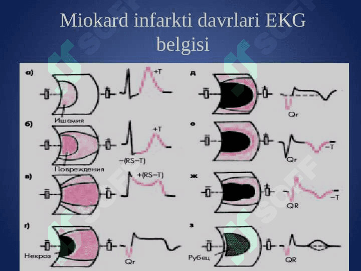 Miokardit va miokardiodistrofiyalarni etiologiyasi, patogenezi va davolash usullari. Miokardit va miokardiodistrofiyalarni davolashda qoMlaniladigan dori vositalarning farmakodinamikasi 7