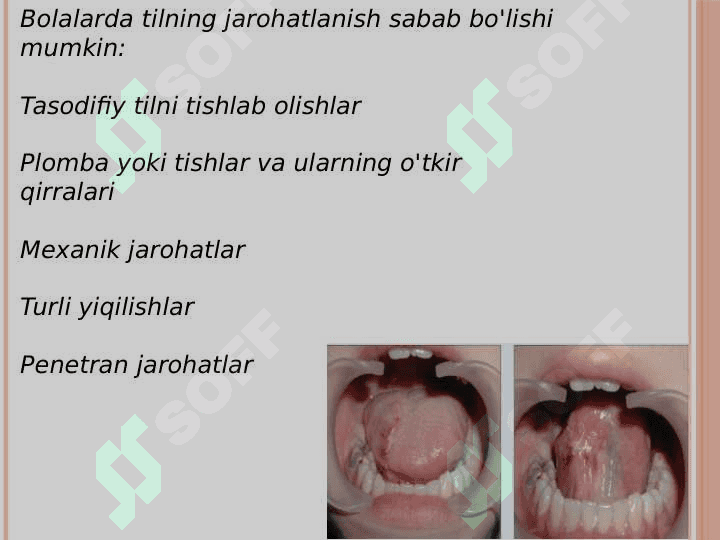 Til jarohati 2