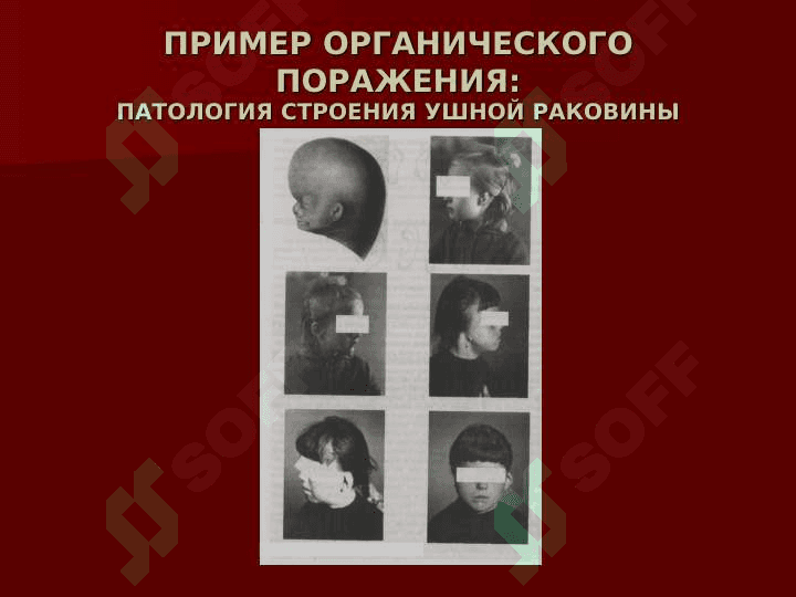 ОБРАЗОВАНИЕ ДЕТЕЙ С НАРУШЕНИЯМИ  СЛУХА 8