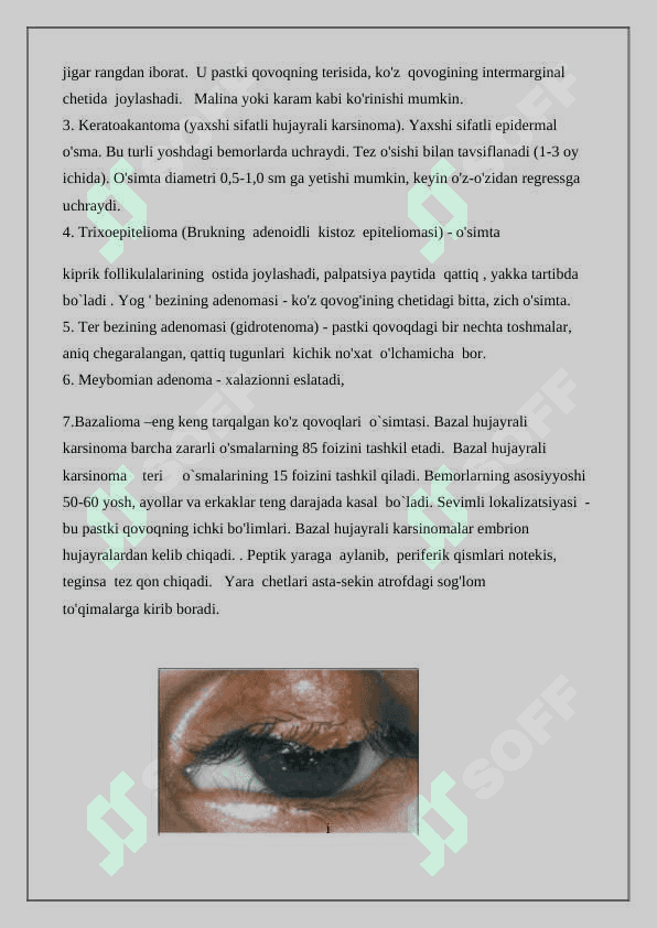 OFTALMOLOGIYA BO’LIMINI TUZILISHIDAGI O’ZIGA XOSLIGI 4