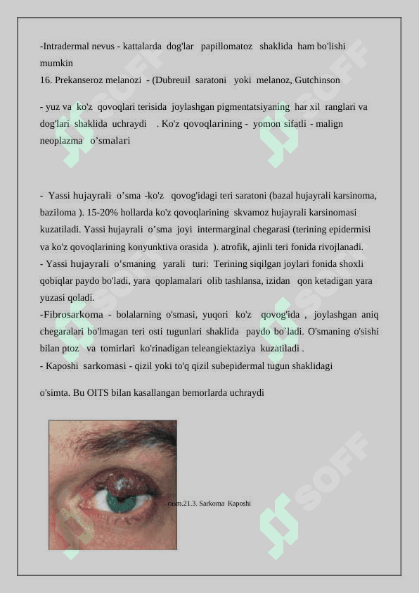 OFTALMOLOGIYA BO’LIMINI TUZILISHIDAGI O’ZIGA XOSLIGI 7