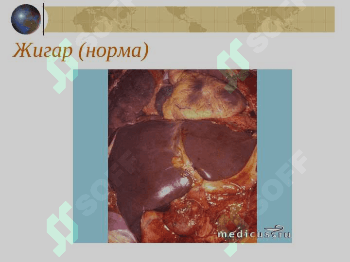 СУРУНКАЛИ ГЕПАТИТ 3