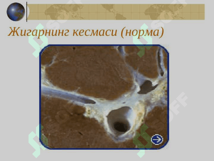 СУРУНКАЛИ ГЕПАТИТ 4