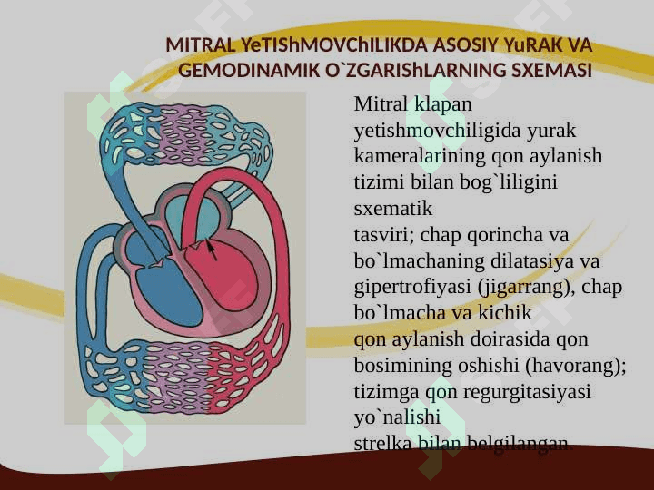 Mitral klapan prolapsi 3
