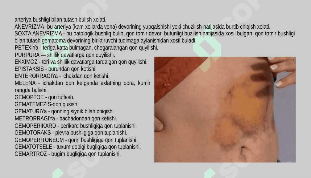 INFUZION TRANSFUZION TERAPIYA 4