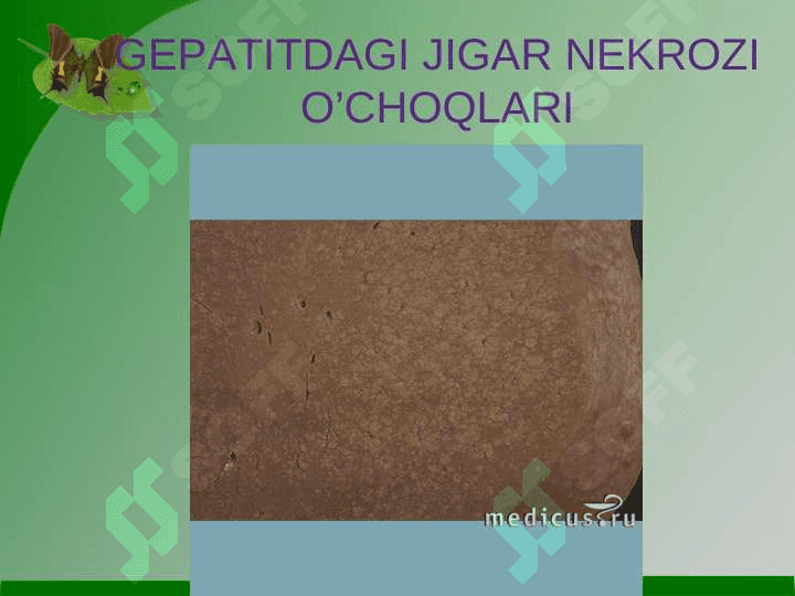 Surunkali gepatit 8