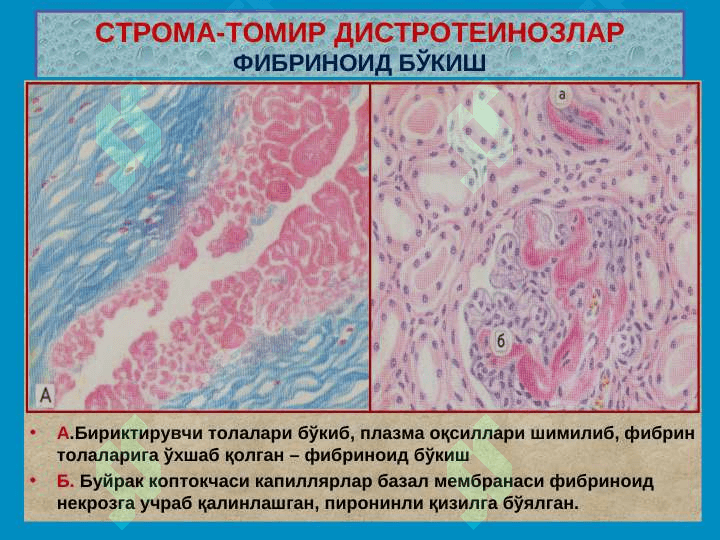 Stroma va tomir distrofiyalari . Distrofiya - distrr=ofiyalar 8