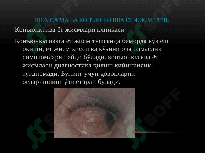 Oftalmologiyada medikamentoz davolash prinsplari 2