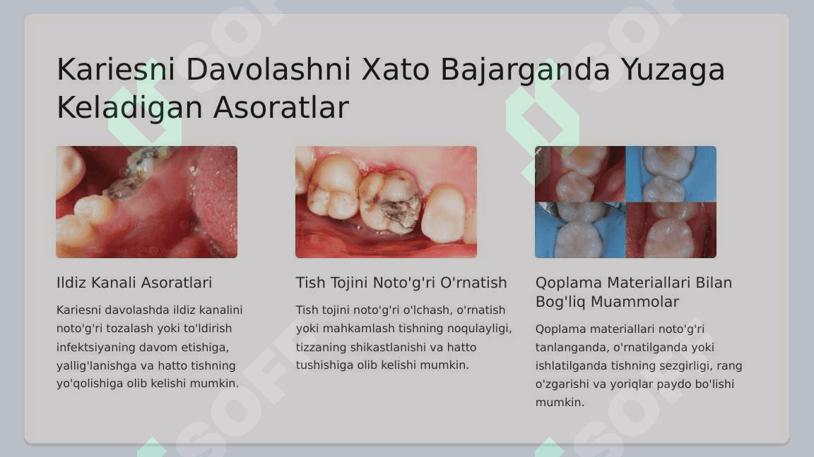 Karies kasalligini  tashxislashda va  davolashda  uchraydigan xato va  asoratlar. 8