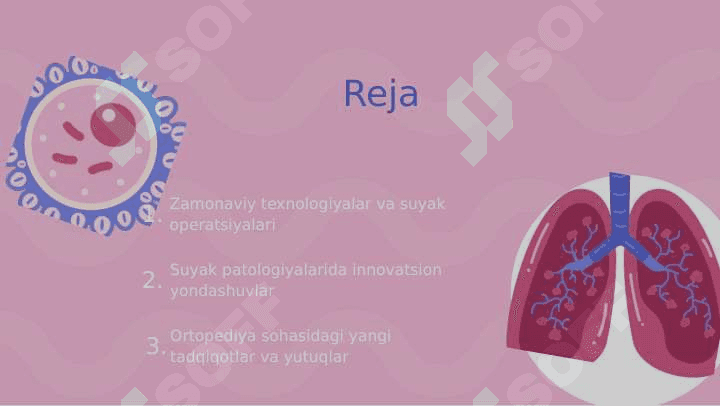 Zamonaviy ortopediya yutuqlari. Suyaklar patologiyalarida bajariladigan operatsiyalar. 2