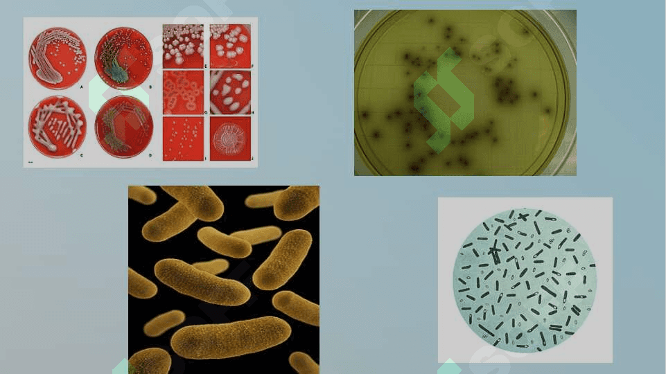 Biologik ashyoni bakterial komtaminatsiyasini biokimyoviy usulda aniqlash. Hirurgik, akusher-ginikologik va unga yondosh bo'lgan bilimlarni sanitar bakteriologik tekshirish va baho berish 4