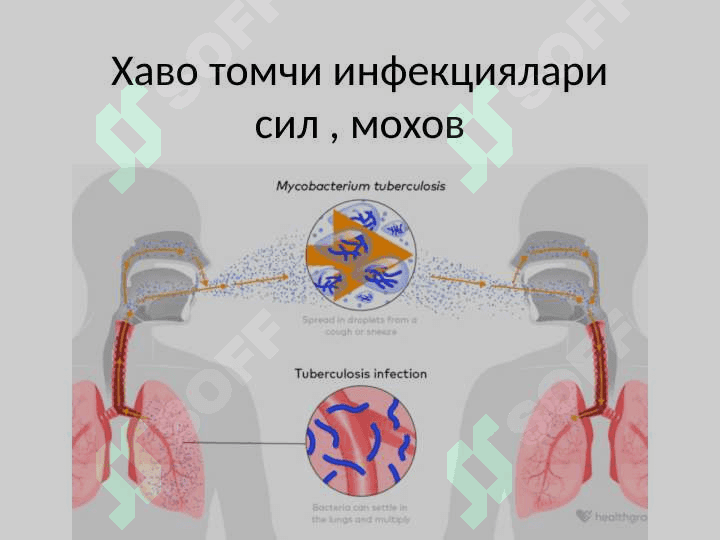 Хаво томчи инфекциялари сил , мохов 2