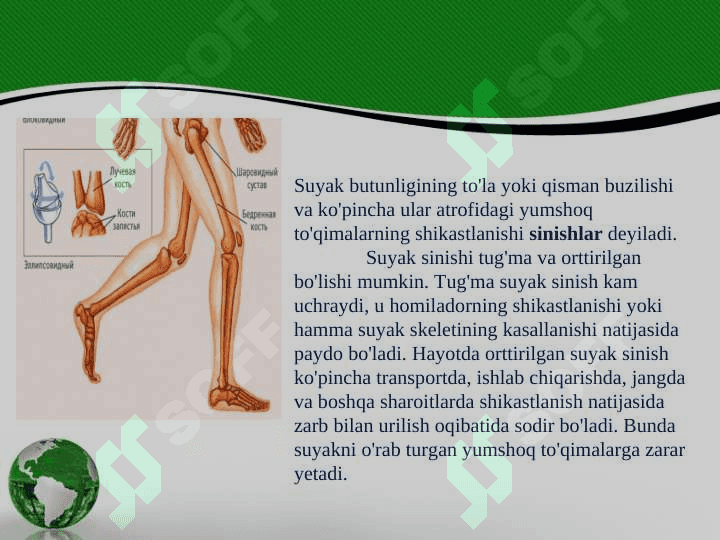 Suyak singanida birinchi yordam ko’rsatish 2