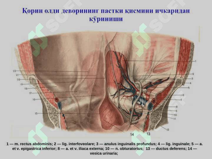 Чов, сон, киндик ва қорин оқ чизиғи чурралари 3