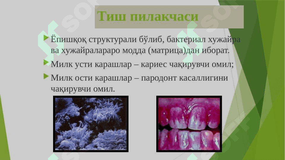 Dog’ bosqichidagi karies
 klinikasi tashxislash 4