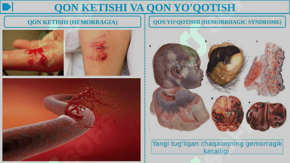 QON KETISH VA QON YO'QOTISH - RASMLI 2