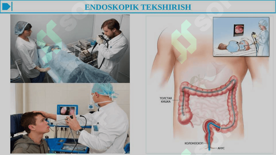 XIRURGIK BEMORLARNI TEKSHIRISH ASOSIY QOIDALARI. XIRURGIK BEMORLARNI TEKSHIRISH QO'SHIMCHA USULLARI - RASMLI 3