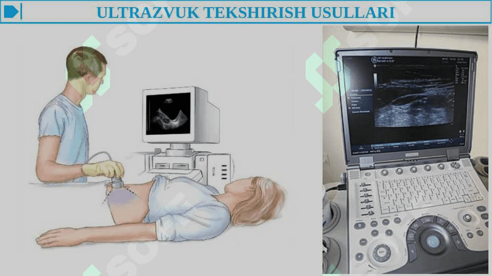 XIRURGIK BEMORLARNI TEKSHIRISH ASOSIY QOIDALARI. XIRURGIK BEMORLARNI TEKSHIRISH QO'SHIMCHA USULLARI - RASMLI 4