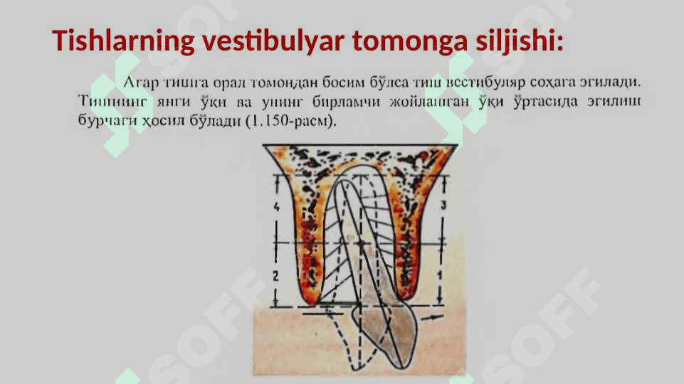 Tishlarni
 siljitish turlari 7