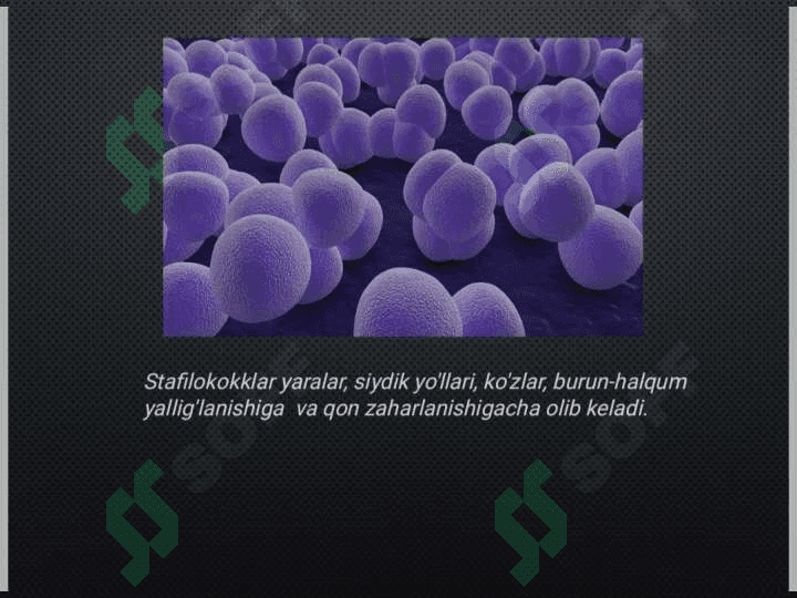 Og'iz atrofi yiringli
 piodermiyasi 5