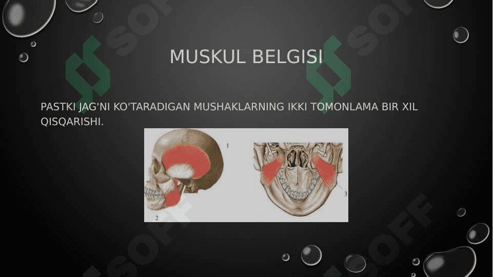Okklyuzia va artikulyatsiya tushunchasi 7
