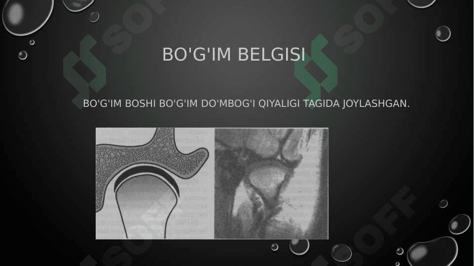 Okklyuzia va artikulyatsiya tushunchasi 8