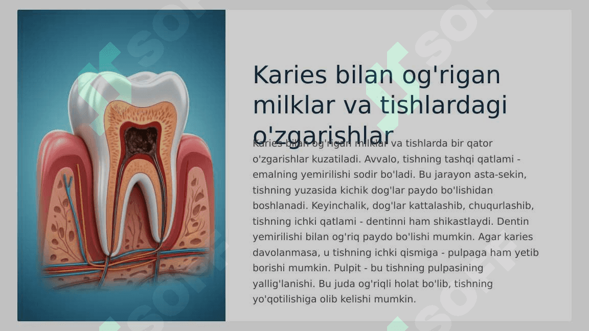 Kariesogen omillar (mahalliy  umumiy). Kariesni ,  patologik anatomiyasi. 6