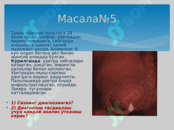 ДЕРМАТОВЕНЕРОЛОГИЯДАН ВАЗИЯТГА ОИД МАСАЛАЛАР 6