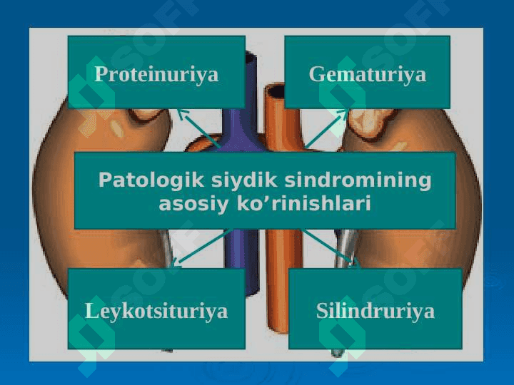 Enurez, Siydik chiqaarish yo’llari neyrogen disfunksiyasi 2