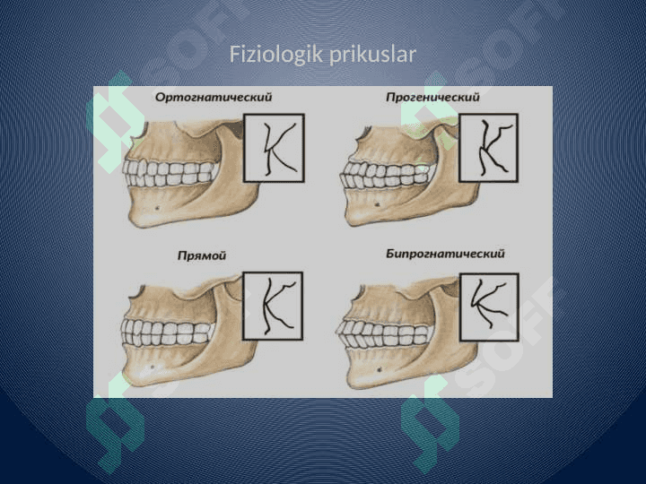 Tish, tish qatorlari va prikus anomaliyalarini rivojlanishini tashxislash 5