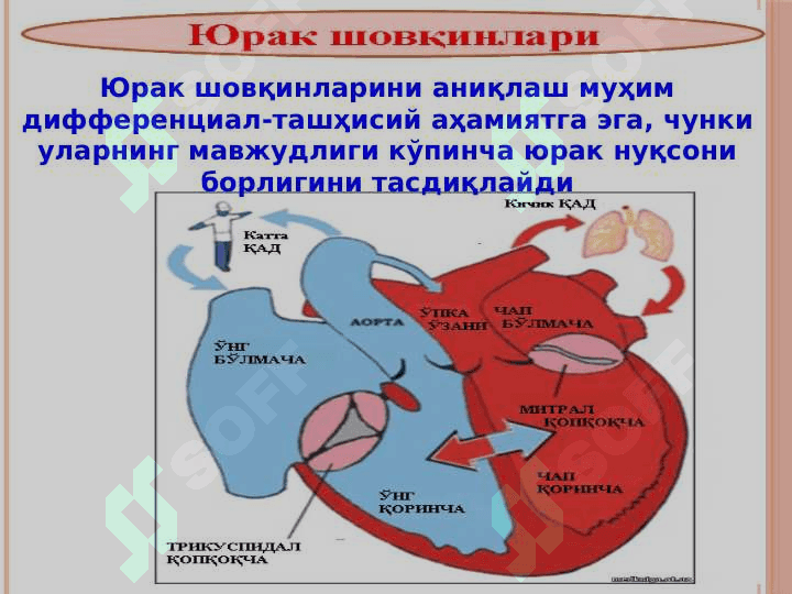 Туғма юрак нуқсонлари юрак шовқинлари 4