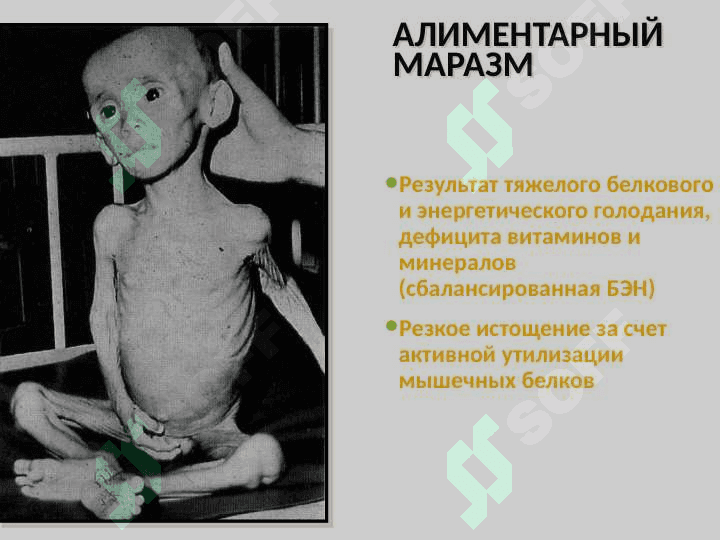 Типовые нарушения обмена белков и нуклеиновых кислот 7