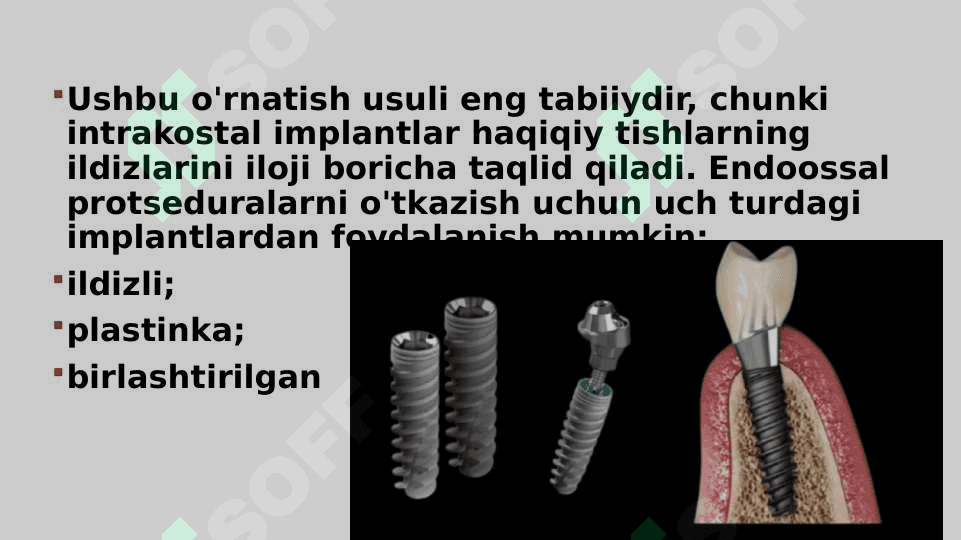 Endoossal implantatsiya 3