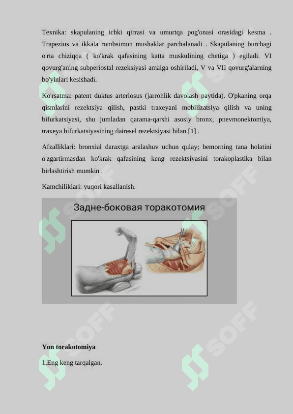 Bolalardagi torakotomiya xususiyatlari 3