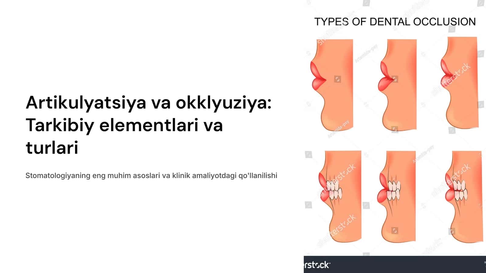 Artikulyatsiya va okklyuziya.Tarkibiy elementlari.Okklyuziya turlari 1