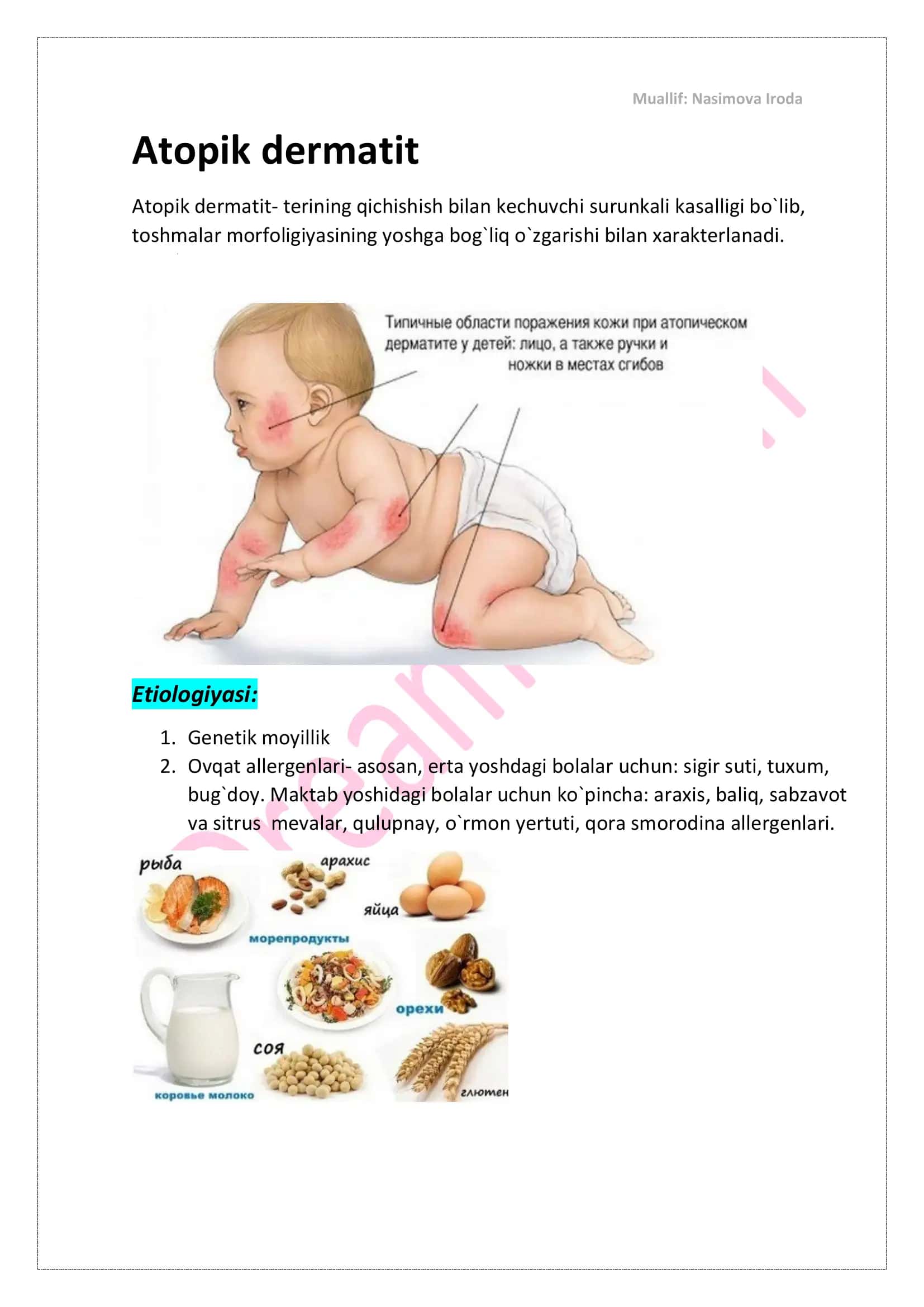 Atopik dermatit 1