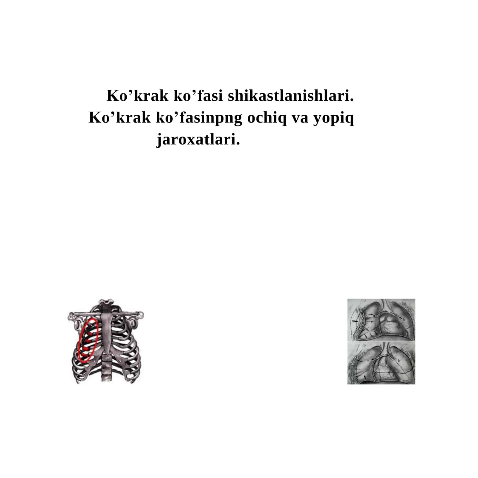 Ko’krak ko’fasi shikastlanishlari 1