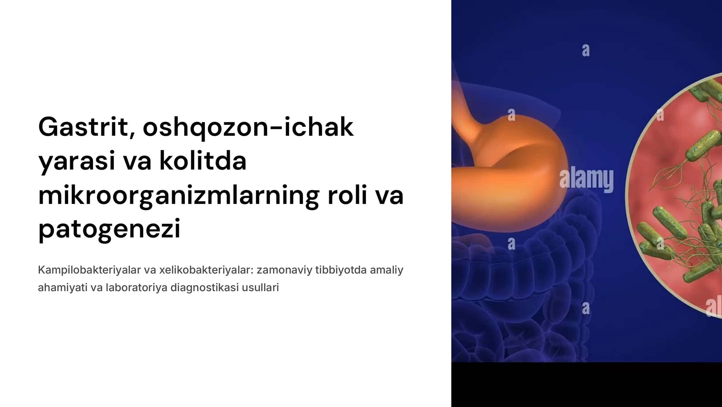 Gastrit, oshqozon-ichak yarasi va kolit kelib chiqishida mikroorganizmlarning ahamiyati, patogenezi, laboratoriya tashxisi. Kampilobakteriyalar, xelikobakteriyalar va ularning amaliyotdagi ahamiyati. 1