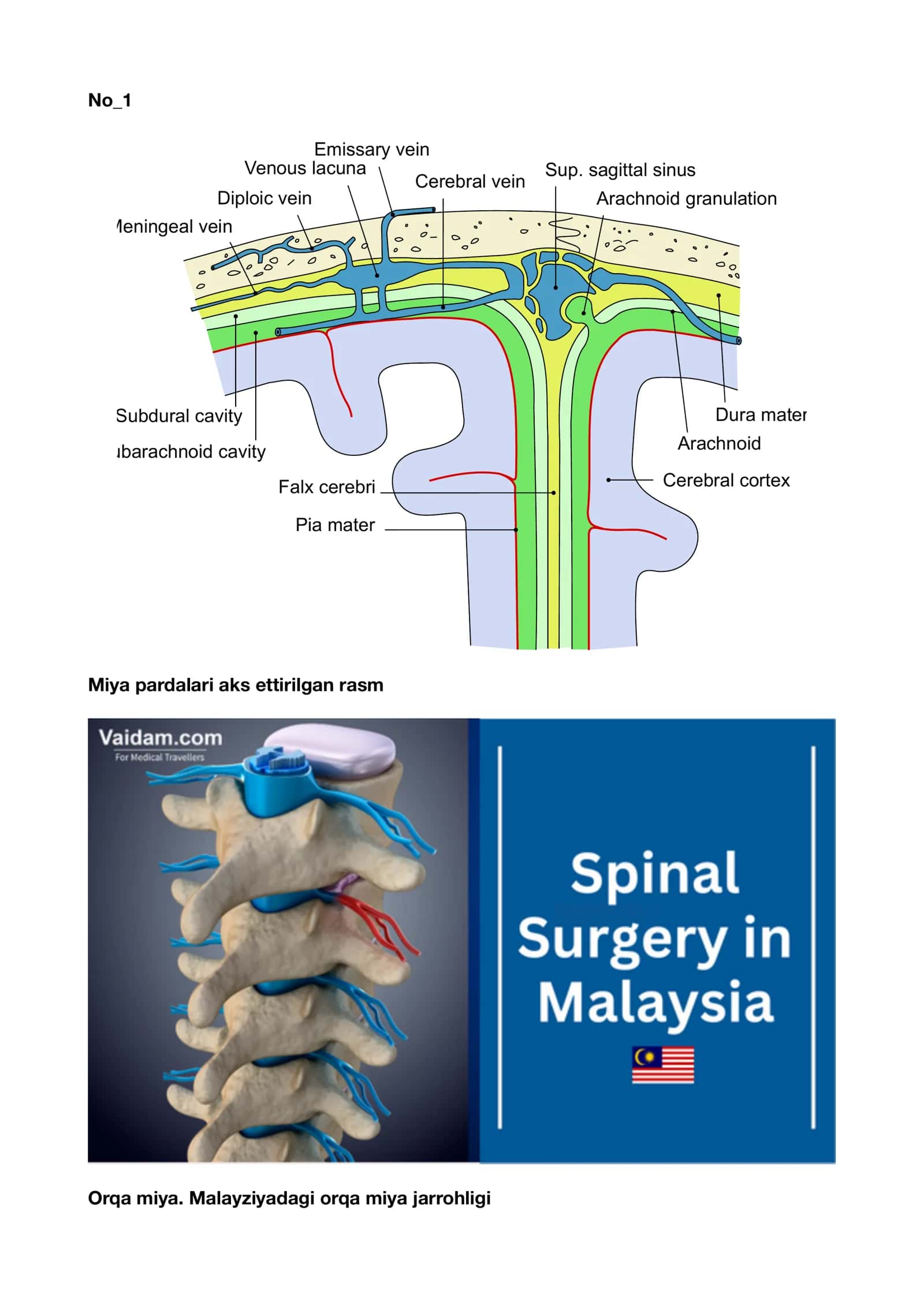 Inson miyasining anatomik preparati 1