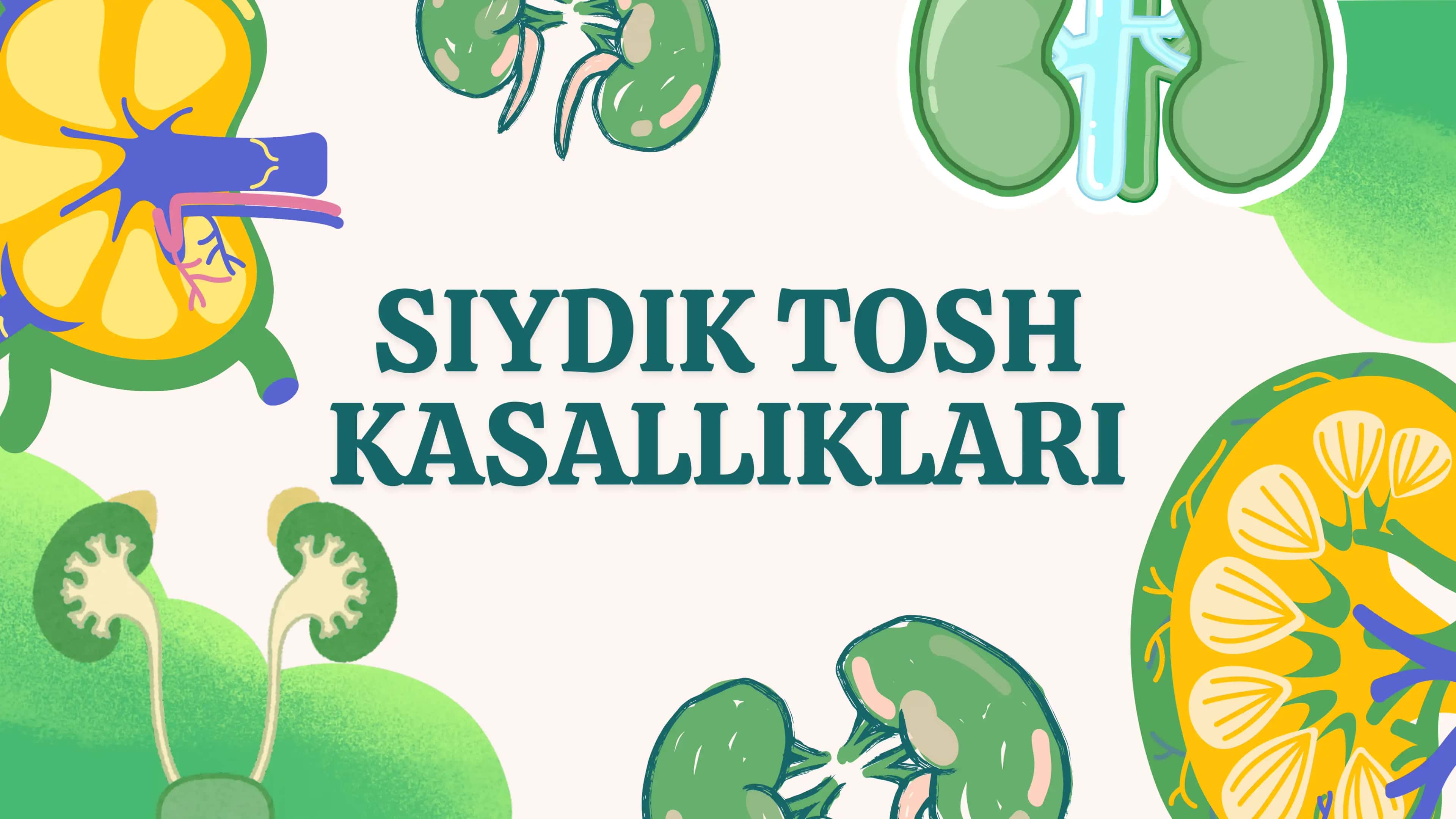 SIYDIK TOSH KASALLIKLARI 1