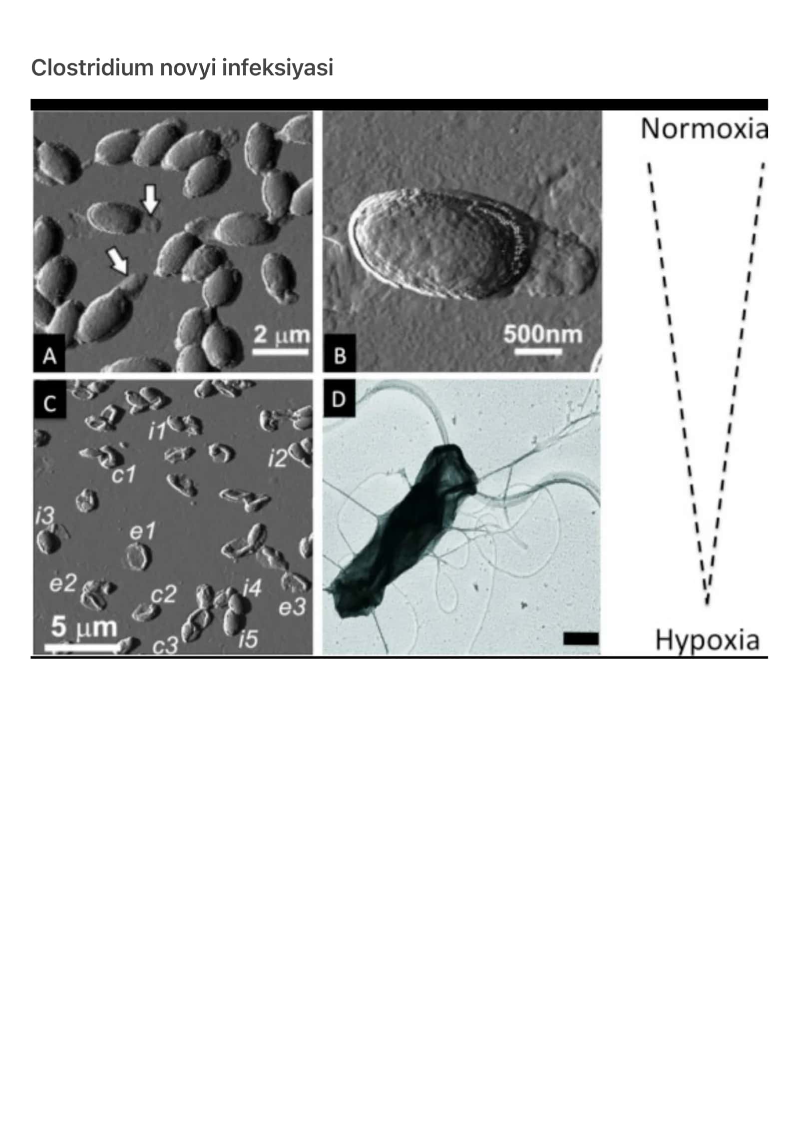 Clostridium novyi infeksiyasi 1