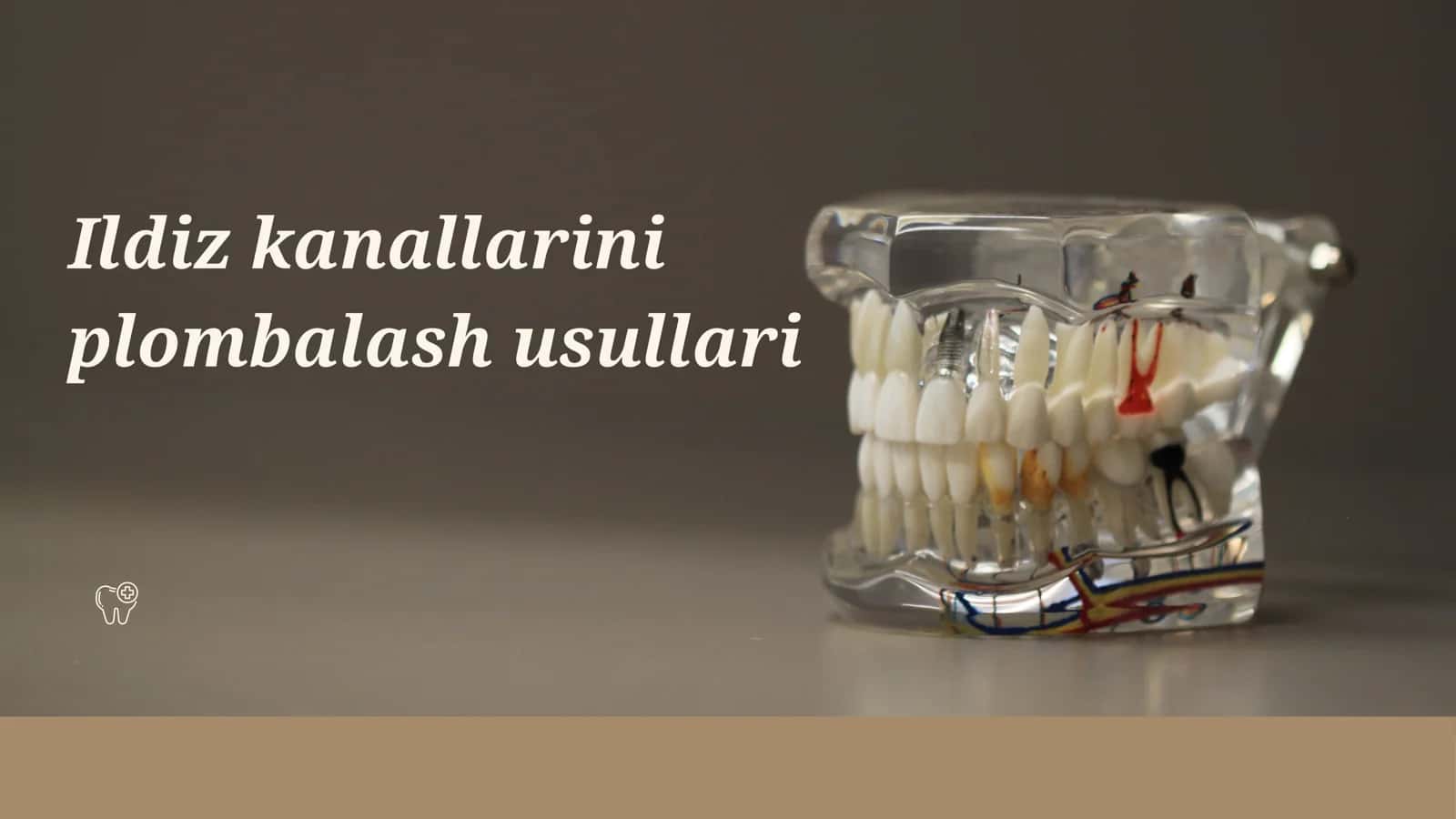 Ildiz kanallarini plombalash usullari 1