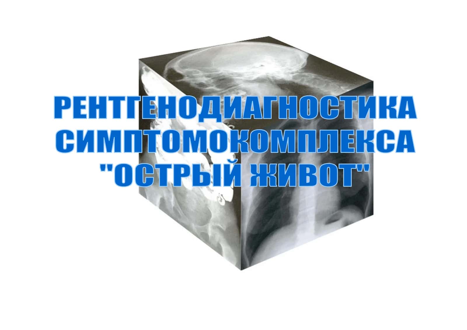 Прободение язвы или опухоли ЖКТ 1