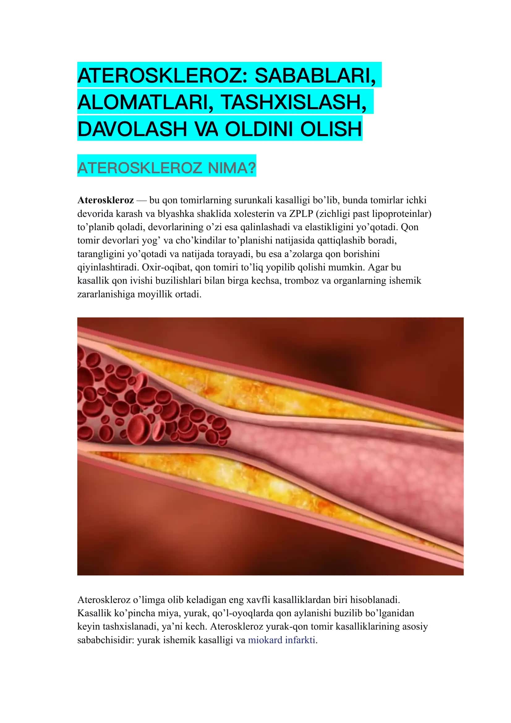Ateroskleroz: sabablari, alomatlari, tashxislash, davolash va oldini olish 1