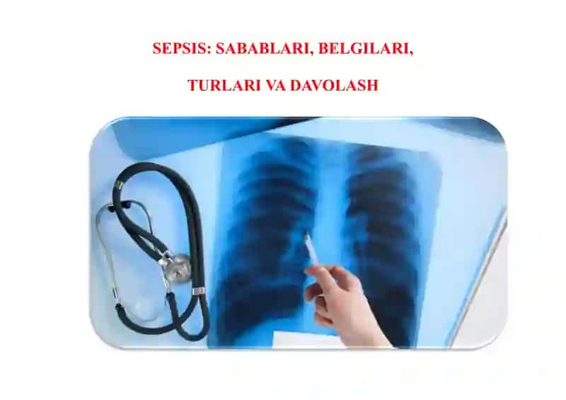 SEPSIS: SABABLARI, BELGILARI, TURLARI VA DAVOLASH