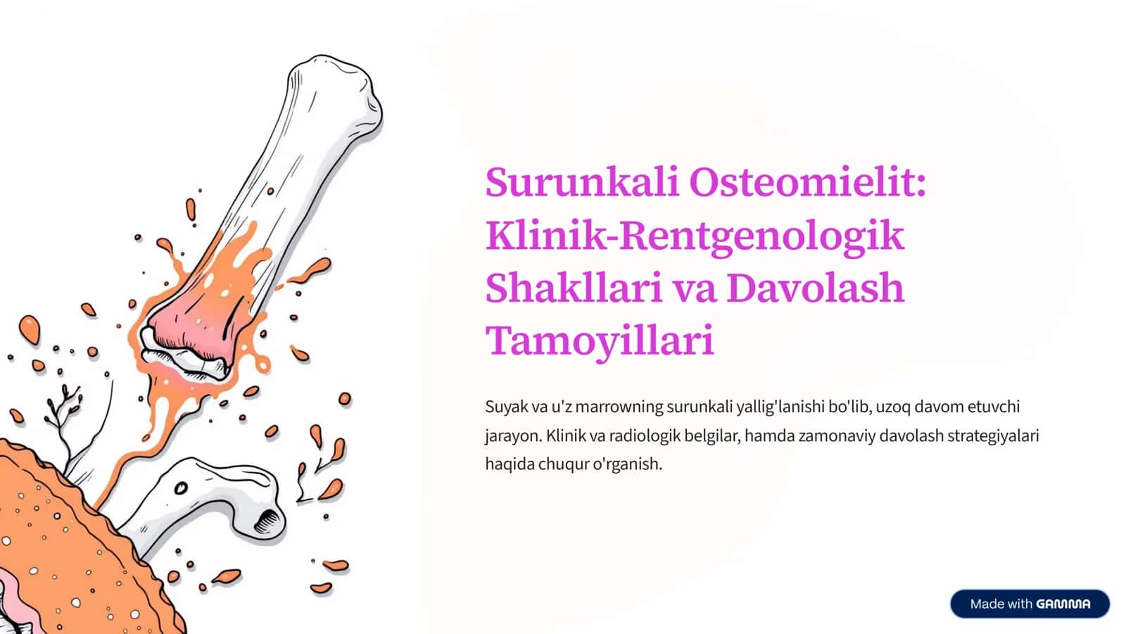 Surunkali Osteomielit: Klinik-Rentgenologik Shakllari va Davolash Tamoyillari 1