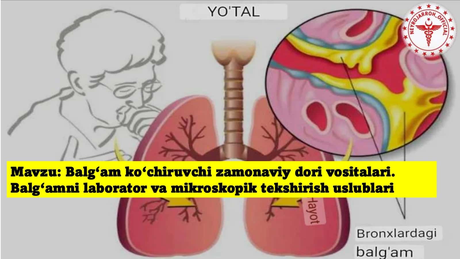 Balg‘am ko‘chiruvchi zamonaviy dori vositalari. Balg‘amni laborator va mikroskopik tekshirish uslublari 2
