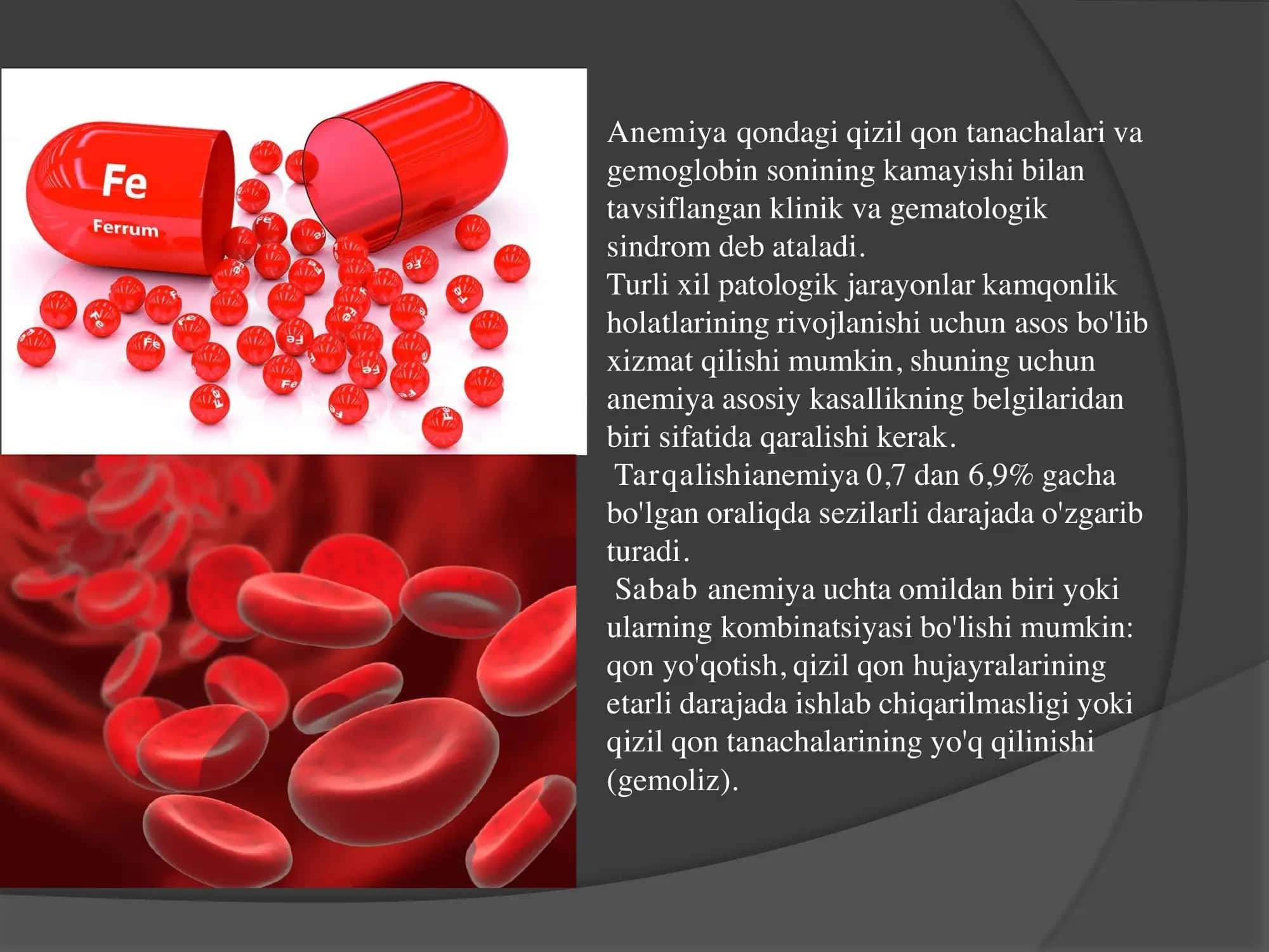 Anemiya Temir tanqisligi kamqonlik 2