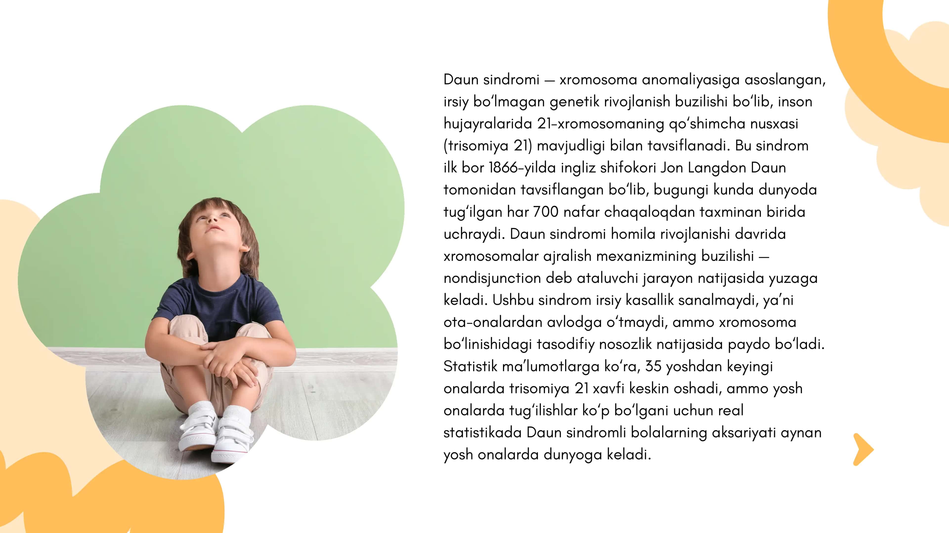 Daun sindromli bolalar 2