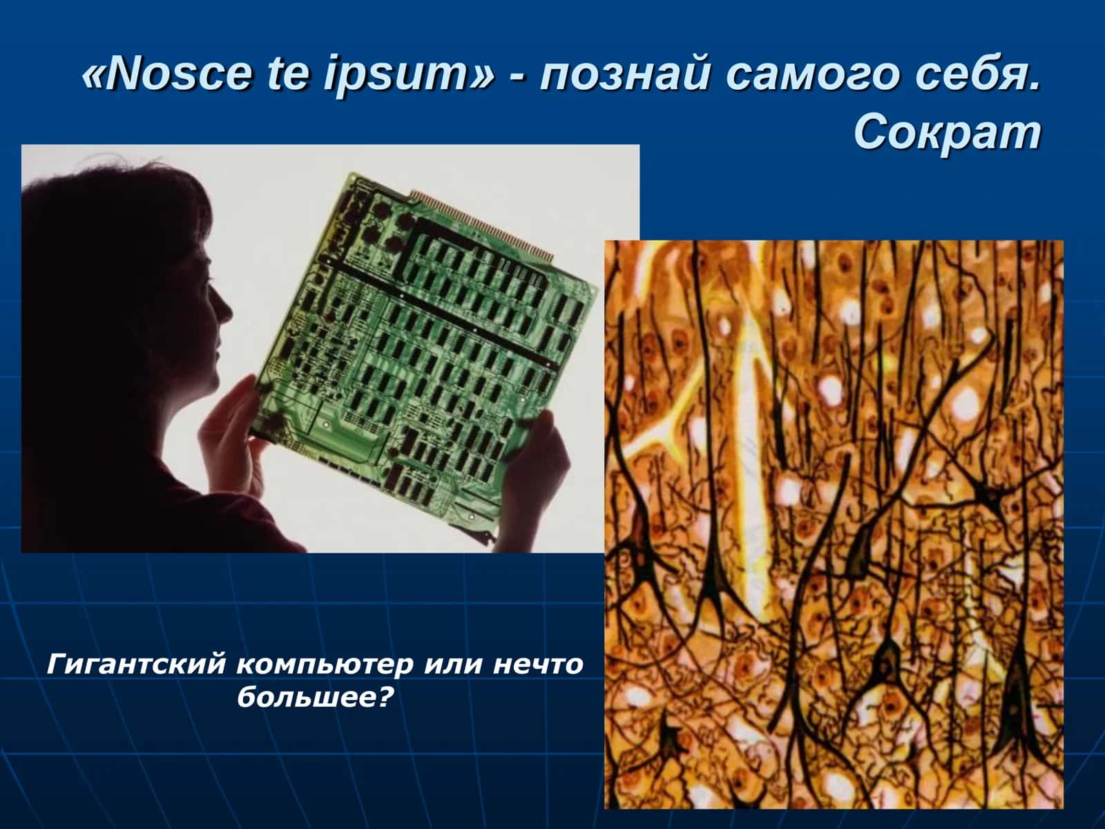 Головной мозг 2